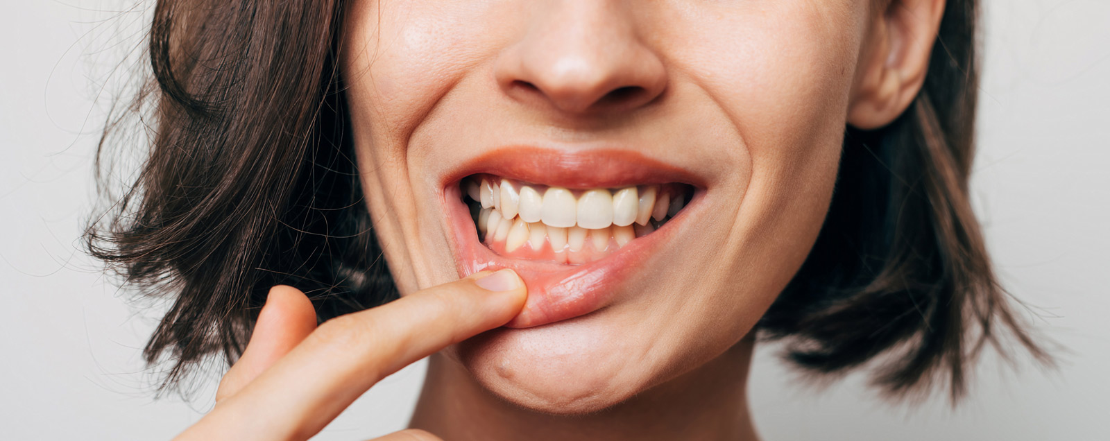Periodoncia Barcelona